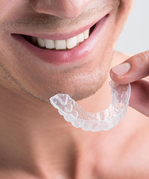 A man smiling with Invisalign® aligners